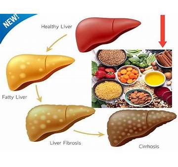 How To Reduce Fat In Liver